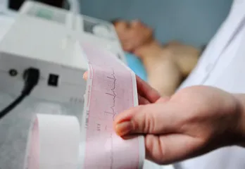 Exame eletrocardiograma Rio de Janeiro